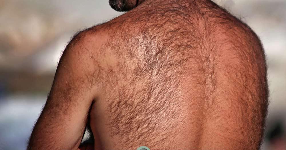 بررسی علت رویش مو در کمر مردان